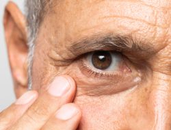 Kenali Gejala Awal Katarak Mata, Sebelum Terlanjur Parah