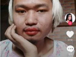 Psikolog Ungkap Popo Barbie Idap Disfora Gender Dan Eksibisionisme? Begini Penjelasannya !