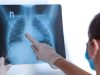 Wabah Pneumonia di China Menyebar, Semoga tidak Sampai Indonesia!